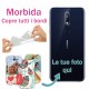 Nokia 7.1 Plus Base1 Cover morbida personalizzata Trasparente